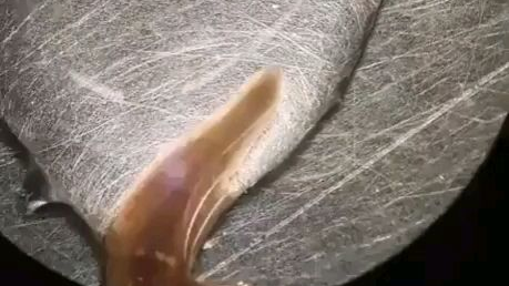 喝水能喝饱的原理